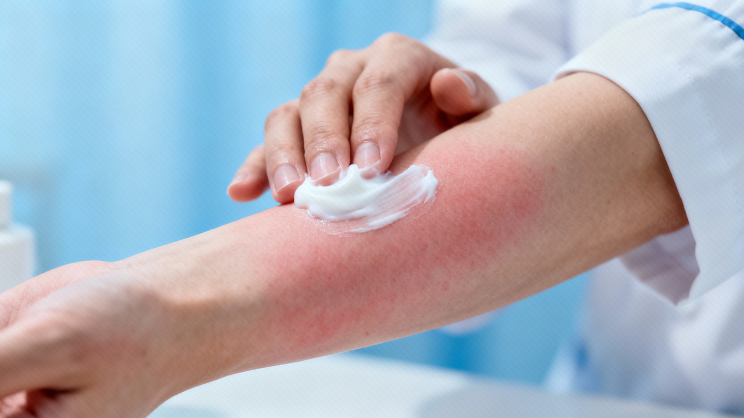 Featured image for Finding Relief: Essential Steps in Managing Contact Dermatitis Flare-Ups